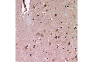 Immunohistochemical analysis of Cadherin 20 staining in human brain formalin fixed paraffin embedded tissue section. (Cadherin 20 anticorps)