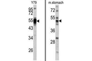 (LEFT) Western blot analysis of PDIA6 antibody (Center K159) in Y79 cell line lysates (35ug/lane). (PDIA6 anticorps  (Middle Region))
