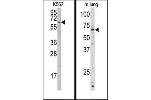 Image no. 1 for anti-Cytochrome P450, Family 1, Subfamily A, Polypeptide 1 (CYP1A1) (AA 384-414), (C-Term) antibody (ABIN360413)