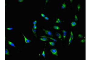 Immunofluorescent analysis of Hela cells using ABIN7154107 at dilution of 1:100 and Alexa Fluor 488-congugated AffiniPure Goat Anti-Rabbit IgG(H+L)