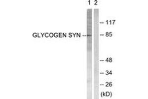 Western blot analysis of extracts from HeLa cells, treated with Serum 20% 30', using Glycogen Synthase (Ab-645) Antibody. (Glycogen Synthase anticorps  (AA 621-670))