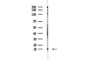anti-Heat Shock Protein, alpha-Crystallin-Related, B6 (HSPB6) (N-Term) antibody