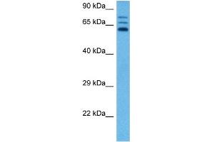 Host:  Rabbit  Target Name:  CBS  Sample Tissue:  Rat Liver  Antibody Dilution:  1ug/ml
