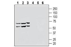 Western blot analysis of human THP-1 monocytic leukemia cell line lysate (lanes 1 and 4), human NK-92 natural killer cell line lysate (lanes 2 and 5) and human HL-60 promyelocytic leukemia cell line lysate (lanes 3 and 6) lysates: - 1-3. (S1PR5 anticorps  (Extracellular, N-Term))