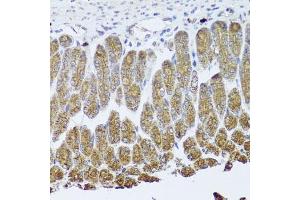 Immunohistochemistry of paraffin-embedded mouse stomach using NTRK1 Antibody (ABIN5971124) at dilution of 1/100 (40x lens). (TRKA anticorps)