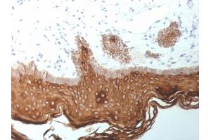 Formalin-fixed, paraffin-embedded human Skin stained with Cytokeratin, 5/6/18 Mouse Monoclonal Antibody (SPM267). (Keratin 5,6,18 anticorps)