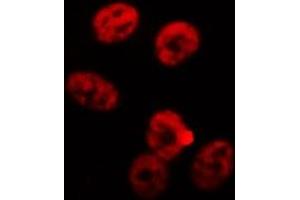 ABIN6268811 staining K-562 cells by IF/ICC. (RBMX anticorps  (N-Term))