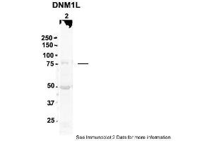 Sample Type: 2. (Dynamin 1-Like anticorps  (N-Term))