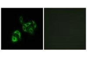 Immunofluorescence analysis of A549 cells, using SLC27A4 antibody. (SLC27A4 anticorps)