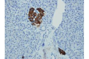 Immunohistochemistry (IHC) image for anti-Synaptophysin (SYP) (AA 293-310), (C-Term) antibody (ABIN7598842)