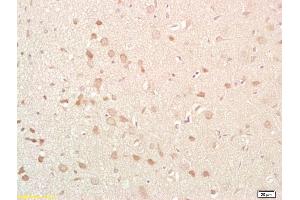 Formalin-fixed and paraffin embedded rat brain labeled with Anti-NKB Polyclonal Antibody, Unconjugated (ABIN724460) at 1:200 followed by conjugation to the secondary antibody and DAB staining (Tachykinin 3 anticorps  (AA 81-90))