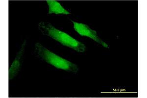 Immunofluorescence of monoclonal antibody to CA10 on HeLa cell. (CA10 anticorps  (AA 229-328))