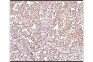 Immunohistochemistry of ORAI1 in human spleen tissue with this product at 2.