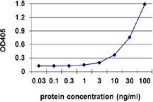 Sandwich ELISA detection sensitivity ranging from 1 ng/ml to 100 ng/ml. (TK1 (Humain) Matched Antibody Pair)