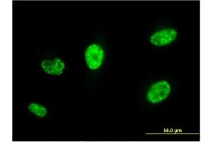 Immunofluorescence of monoclonal antibody to PCGF5 on HeLa cell. (PCGF5 anticorps  (AA 51-148))