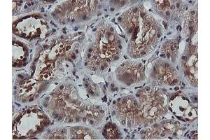 Image no. 4 for anti-V-Akt Murine Thymoma Viral Oncogene Homolog 1 (AKT1) antibody (ABIN1496556) (AKT1 anticorps)