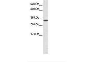 Image no. 1 for anti-Excision Repair Cross-Complementing Rodent Repair Deficiency, Complementation Group 8 (ERCC8) (AA 37-86) antibody (ABIN6736089)