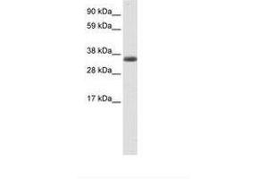Image no. 1 for anti-Excision Repair Cross-Complementing Rodent Repair Deficiency, Complementation Group 8 (ERCC8) (AA 37-86) antibody (ABIN6736089) (ERCC8 anticorps  (AA 37-86))