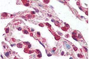 Human Lung (formalin-fixed, paraffin-embedded) stained with CCR3 antibody ABIN461875 at 2.