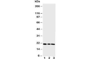 Western blot testing of PBP antibody and Lane 1:  rat brain;  2: (r) lung;  3: (r) liver (PEBP1 anticorps  (N-Term))
