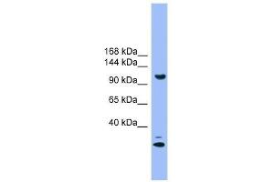 Western Blot showing STARD8 antibody used at a concentration of 1.