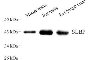 Western blot analysis of SLBP (ABIN7075733) at dilution of 1: 500 (SLBP anticorps)