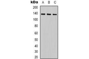 Western blot analysis of HER2 expression in HEK293T (A), 22RV1 (B), Hela (C) whole cell lysates. (ErbB2/Her2 anticorps)