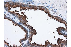 Immunohistochemical staining of paraffin-embedded Human prostate tissue using anti-PANK2 mouse monoclonal antibody. (PANK2 anticorps)