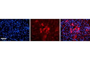 Rabbit Anti-METTL5 Antibody Catalog Number: ARP54982_P050 Formalin Fixed Paraffin Embedded Tissue: Human Liver Tissue Observed Staining: Cytoplasm in hepatocytes and sinusoids Primary Antibody Concentration: 1:100 Other Working Concentrations: 1:600 Secondary Antibody: Donkey anti-Rabbit-Cy3 Secondary Antibody Concentration: 1:200 Magnification: 20X Exposure Time: 0. (METTL5 anticorps  (N-Term))