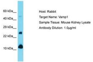 Image no. 1 for anti-Vesicle-Associated Membrane Protein 1 (Synaptobrevin 1) (VAMP1) (N-Term) antibody (ABIN6750496) (VAMP1 anticorps  (N-Term))