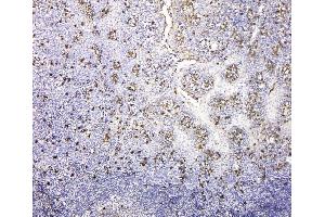 IHC analysis of IGLL1 using anti-IGLL1 antibody (ABIN6719329). (IGLL1 anticorps)