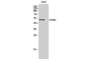 Western Blotting (WB) image for anti-Cytochrome P450, Family 4, Subfamily B, Polypeptide 1 (CYP4B1) (Internal Region) antibody (ABIN3174667) (CYP4B1 anticorps  (Internal Region))