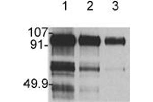 Western blot analysis: Lane 1 hHGF 1 μg, Lane 2 hHGF 0. (HGF anticorps)