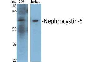 Western Blot (WB) analysis of specific cells using Nephrocystin-5 Polyclonal Antibody. (IQCB1 anticorps  (Internal Region))