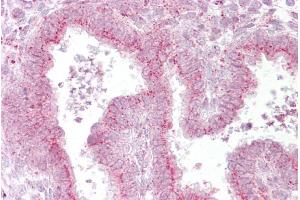 Immunohistochemistry with Uterus tissue at an antibody concentration of 5µg/ml using anti-GOLGB1 antibody (ARP46464_P050)