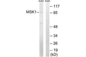 Western blot analysis of extracts from mouse brain cells, using MSK1 (epitope around residue 212) antibody. (MSK1 anticorps  (Ser212))