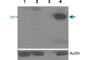 HEK293 overexpressing TANK2 (lane 4) and TANK1 (lane 2) and probed with TNKS2 polyclonal antibody  (mock transfection in first lane). (TNKS2 anticorps)