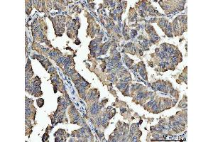 IHC analysis of ARL13B using anti-ARL13B antibody (ABIN7600179).