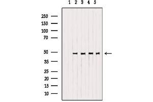 Western blot analysis of extracts from various samples, using OPRM1 Antibody. (Mu Opioid Receptor 1 anticorps  (C-Term))