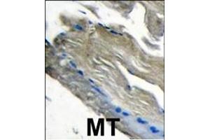 Formalin-fixed and paraffin-embedded human muscle tissue tissue reacted with PI3CKG antibody (C-term) (ABIN392816 and ABIN2842247) , which was peroxidase-conjugated to the secondary antibody, followed by DAB staining. (PIK3 gamma anticorps  (C-Term))