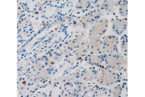 Used in DAB staining on fromalin fixed paraffin- embedded stomach tissue