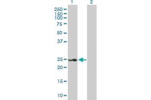 Western Blot analysis of RAD54B expression in transfected 293T cell line by RAD54B MaxPab polyclonal antibody. (RAD54B anticorps  (AA 1-158))