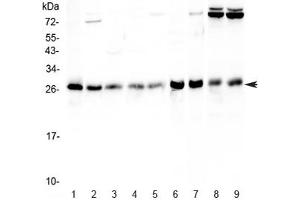 Western blot testing of human 1) HeLa, 2) Jurkat, 3) MCF7, 4) HepG2, 5) A549, 6) rat stomach, 7) rat thymus, 8) mouse thymus and 9) mouse NIH3T3 lysate with RAB27A antibody at 0. (RAB27A anticorps)