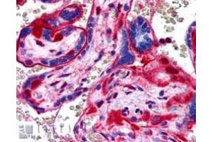 Image no. 1 for anti-Annexin A11 (ANXA11) (N-Term) antibody (ABIN374162) (Annexin A11 anticorps  (N-Term))