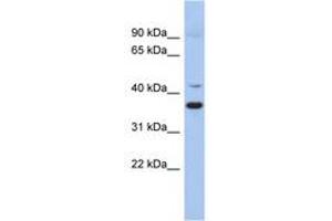 Image no. 1 for anti-Glutamate Decarboxylase-Like 1 (GADL1) (AA 215-264) antibody (ABIN6743948) (GADL1 anticorps  (AA 215-264))
