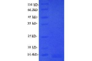 SDS-PAGE (SDS) image for Hemoglobin Protein (GLBO) (full length) protein (ABIN618068)