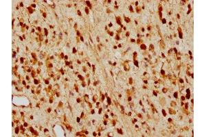IHC image of ABIN7127421 diluted at 1:97. (Recombinant CDKN1B anticorps)