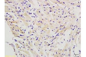 Formalin-fixed and paraffin embedded rat heart labeled with Anti-FLIP Polyclonal Antibody, Unconjugated  at 1:200 followed by conjugation to the secondary antibody and DAB staining. (FLIP anticorps  (AA 401-480))