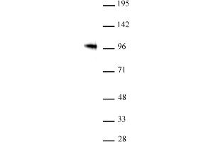 SOX6 antibody (pAb) tested by Western blot. (SOX6 anticorps  (AA 1-20))