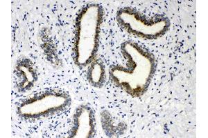 IHC analysis of HSD17B4 using anti- HSD17B4 antibody .